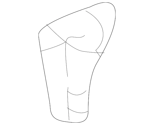 Fender Spacer - Volvo (32409752)